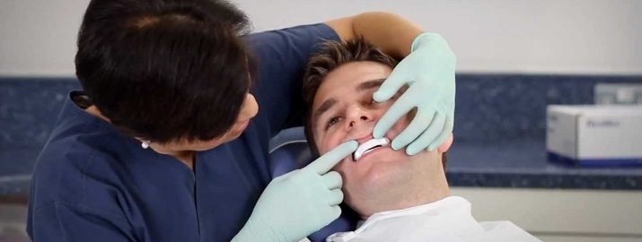 Sleep dentist checking fit of sleep apneal oral applaince