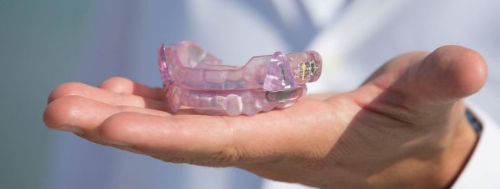 Hand holding a custom oral appliance