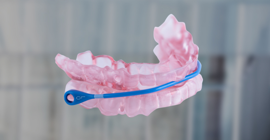 Custom somnodent avant sleep apnea oral appliance